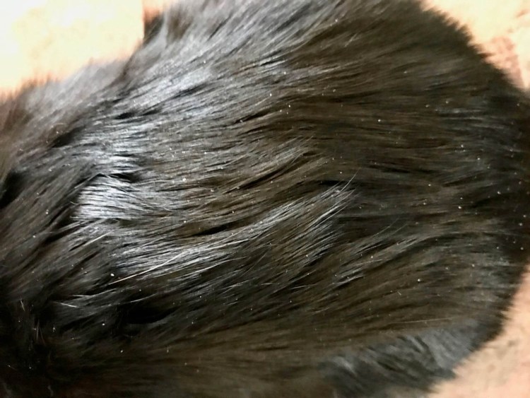 Отрубевидный лишай перхоть