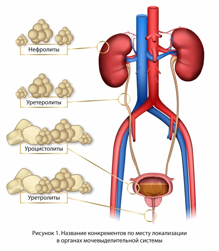 Камни в мочевом пузыре у собаки шпиц
