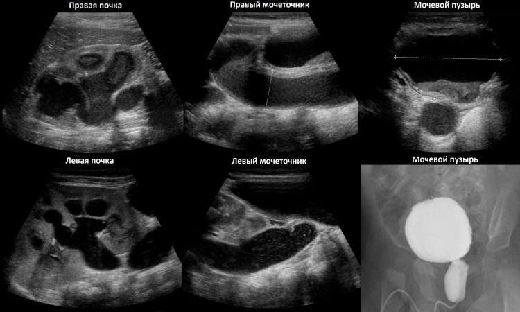 Анализ крови биохимия при мочекаменной болезни у котов
