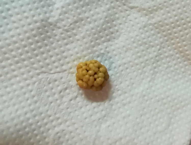 Мочекаменная болезнь мкб у кота