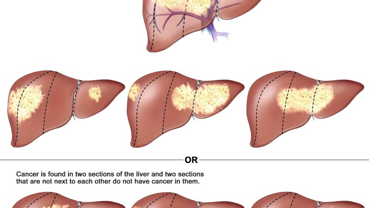 FIP инфекционный перитонит кошек