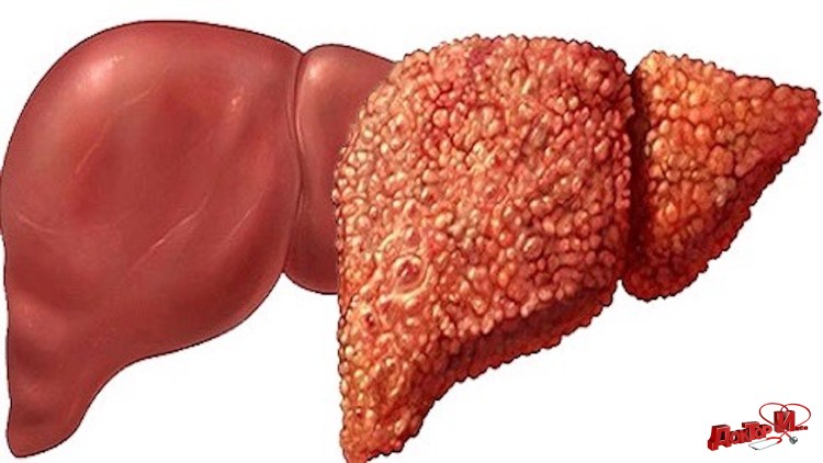 Мазь от стригущего лишая у котенка