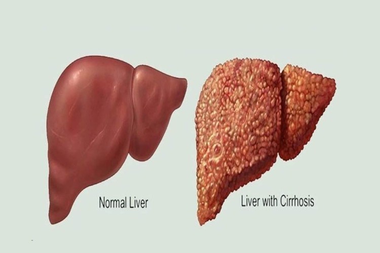 Сегменты печени человека