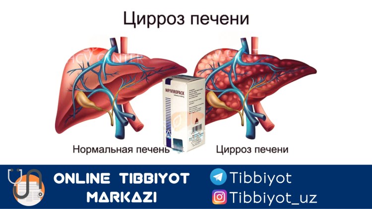 Неалкогольный жировой гепатоз печени