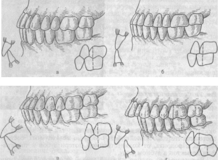 Гингивит стоматит у кошек