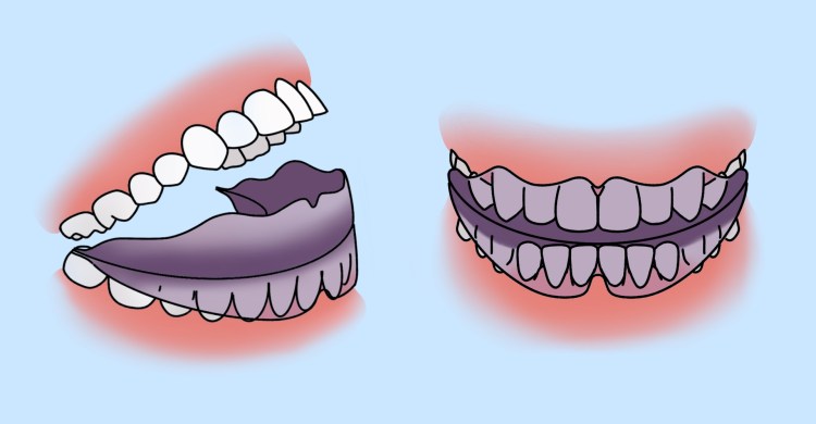Ножницеобразный прикус у собак