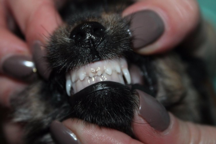 Дистальный прикус ретрузия