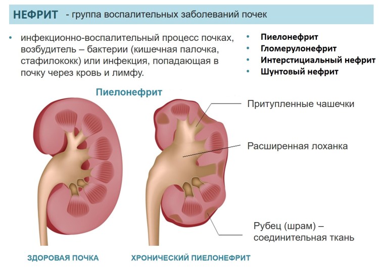 Лекарство для кошек от мочекаменной болезни