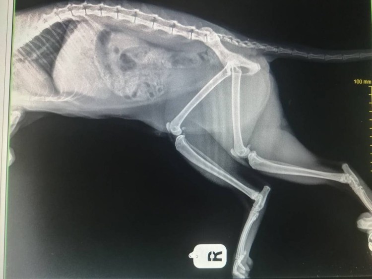 Алиментарный гиперпаратиреоз